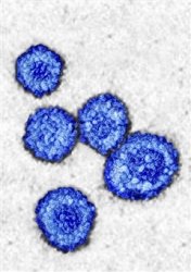 Rubella Virus