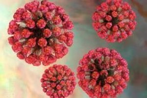 German measles virus or bacteria